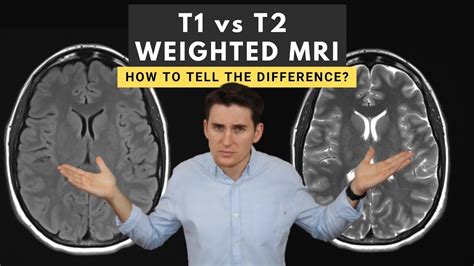 what is t1 in blood test